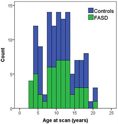 Brain structural differences in children with fetal alcohol spectrum disorder and its subtypes